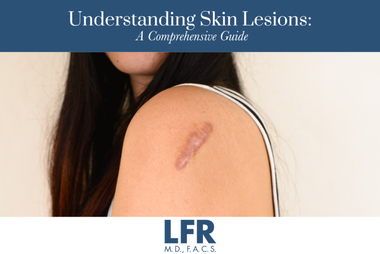 Understanding Skin Lesions: A Comprehensive Guide | Laureen Forgione ...